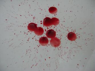 <img0*250:stuff/Blood_Splatter.jpg>